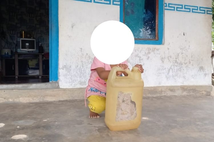 Seorang balita kecanduan cium aroma pertalite.