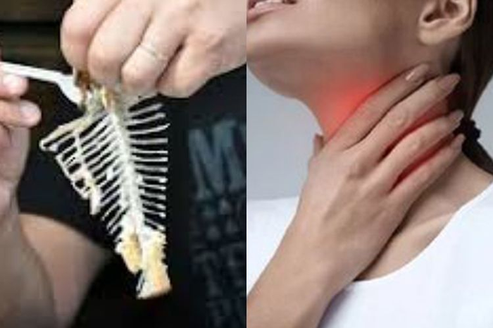 Tips hidup cara atasi tulang ikan yang tersangkut di tenggorokan