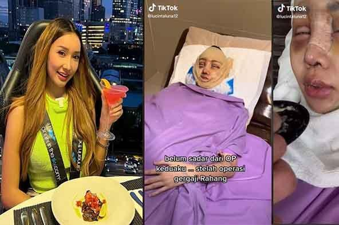 Lucinta Luna bedah rahang dan tulang ekor kini akui kesulitan makan.