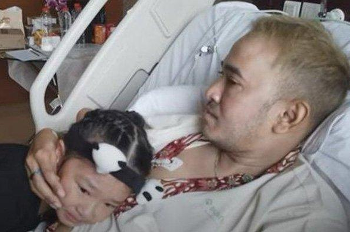Kondisi Ruben Onsu setelah mengidap Empty Sella Syndrome