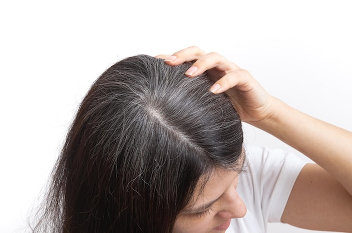 Uban di rambut bisa hilang dengan menggunakan 1 sayuran ini.