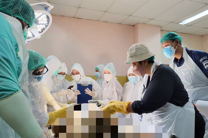 Pemimpin autopsi ulang korban pembunuhan Subang beri jawaban menohok soal otak Brigadir J pindah ke perut. Foto dokter Hastry dibahas.