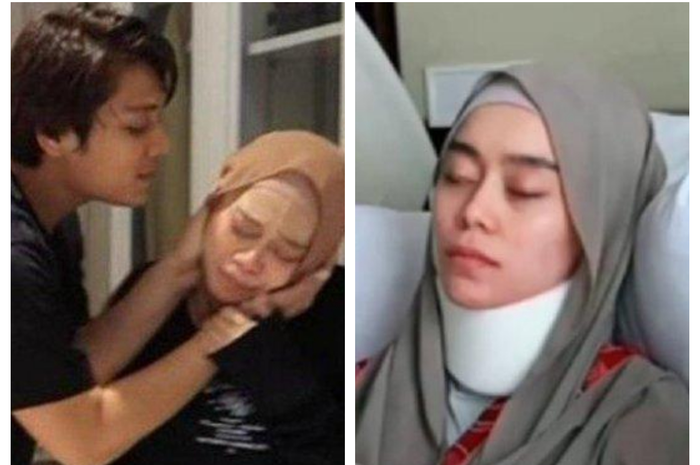 Lesti Kejora alami banyak luka di tubuhnya, polisi sebut KDRT Rizky Billar terparah