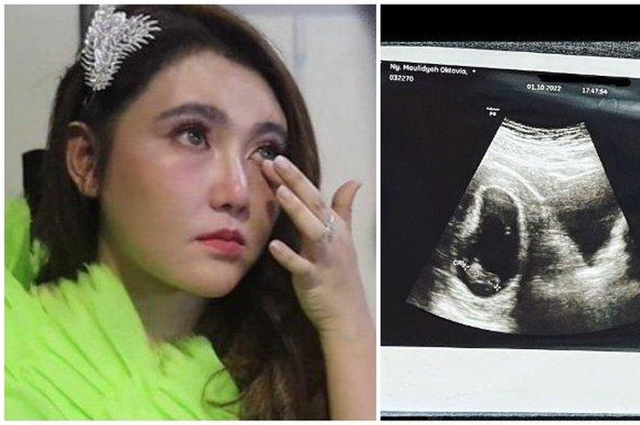 Via Vallen ceritakan kondisi janin yang dikandung, tak berdetak dan tak berkembang.