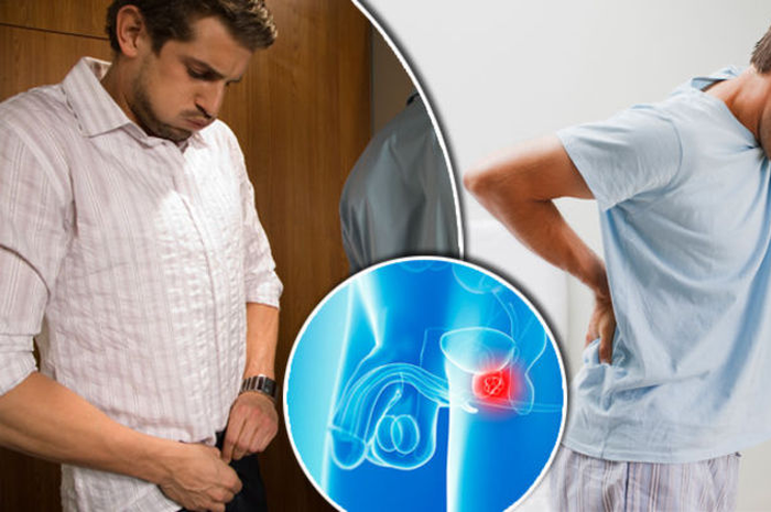 Tips hidup sehat menjaga kesehatan agar tidak terkena kanker prostat