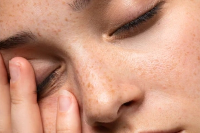 Tips hidup ubah kulit kusam jadi glowing