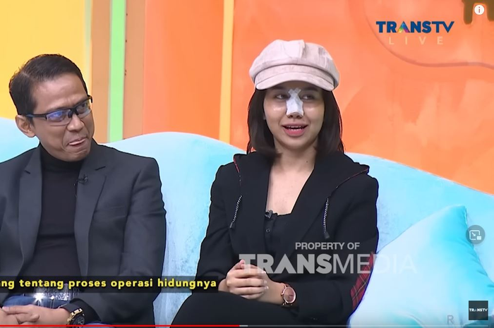 Mayang melakukan operasi plastik di bagian hidungnya, doddy Sudrajat dituding jadikan sang anak mesin uang.