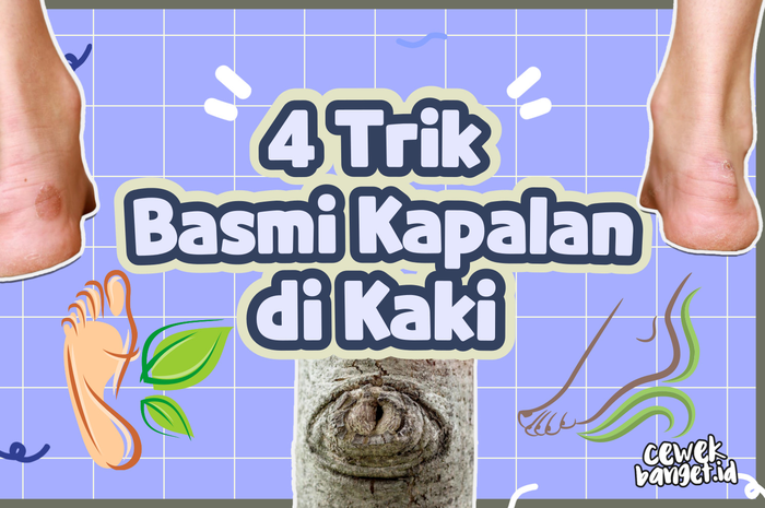 4 Trik Basmi Kapalan di Kaki