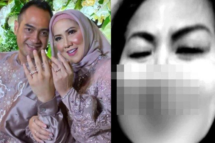 Ferry Irawan ternyata lakukan ini hingga bikin hidung Venna Melinda banjir darah