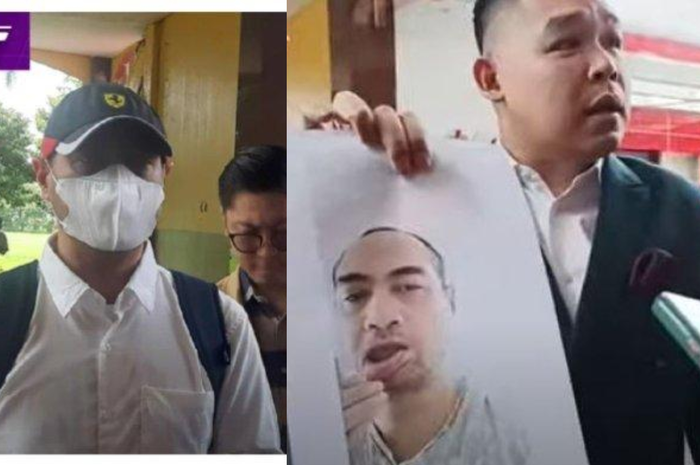 Ferry Irawan jalani pemeriksaan bawa bukti dokumen foto bibir terluka akibat cakaran