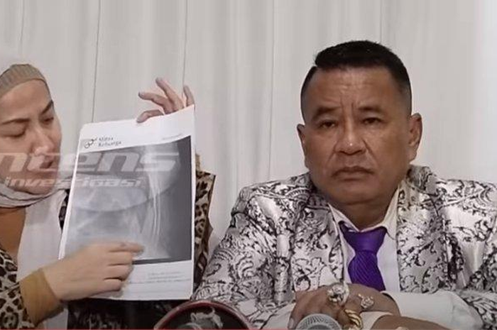 Venna Melinda didampingi Hotman Paris Hutapea tunjukkan bukti tulang rusuk retak imbas KDRT Ferry Irawan