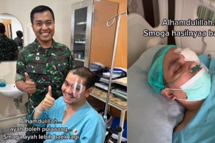 Indra Bekti bakal jalani operasi mata kanan dalam waktu dekat