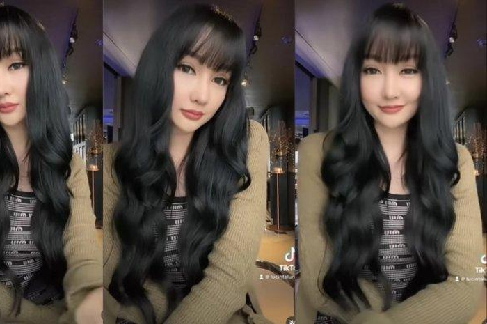 Penampakan wajah Lucinta Luna pasca operasi hidung
