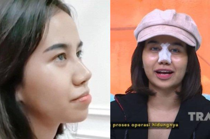 Tak kapok operasi plastik demi tampil glow up, Mayang berencana bakal lakukan oplas lagi