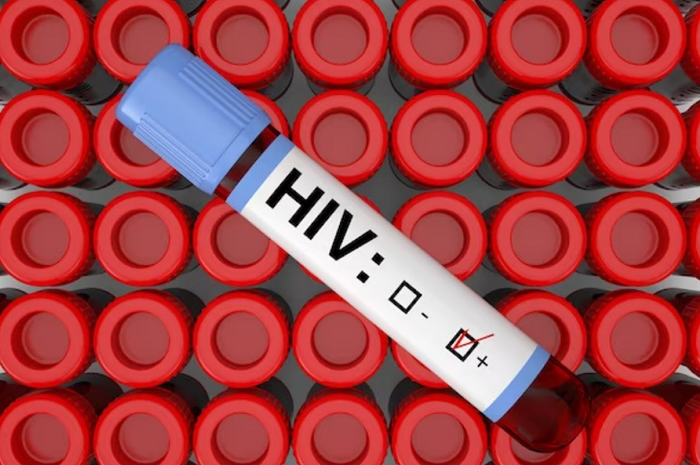 HIV