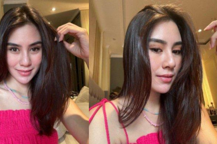 Hidungnya tampak berbeda, Syahnaz dituding operasi plastik