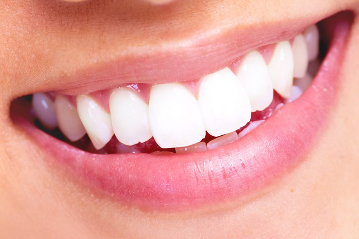 Rekomendasi whitening strip