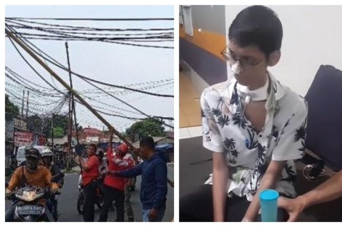 Sultan Rifat Alfatih (20), mahasiswa korban kabel fiber optik menjuntai di Jalan Pangeran Antasari, Jakarta Selatan, rencananya akan dirawat tim dokter spesialis RS Polri. 