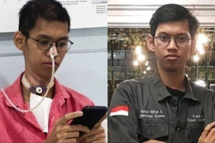 Selain berat badan anjlok, ini fakta lain tentang kondisi pemotor Sultan Rifat usai kecelakaan.