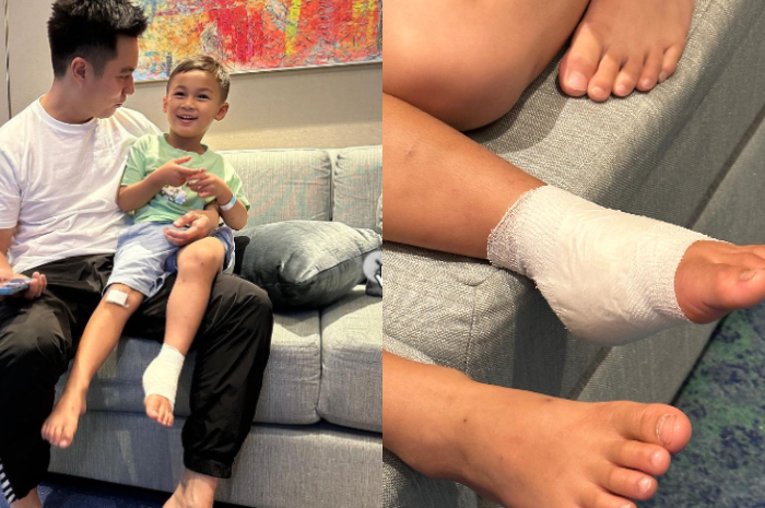 Kaki Kiani Tiger Wong terluka