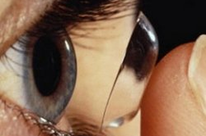 Bahaya Salah Memakai Softlense