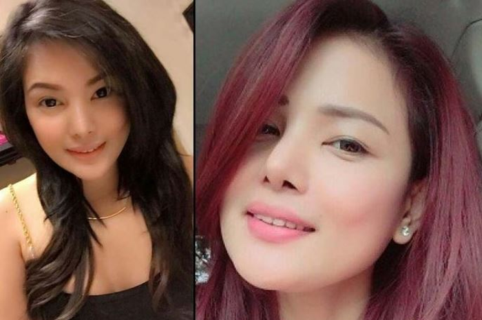Wanita yang tewas akibat menjalani operasi plastik.