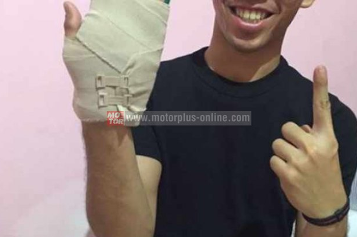 Gerry salim patah tulang metacarpal usai berlaga di race kedua ajang Supersport 600 cc Asia Road Racing Championship (ARRC) di sirkuit Buddh International, India (02/10).