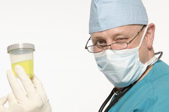 Tes Urine Deteksi Kanker Prostat