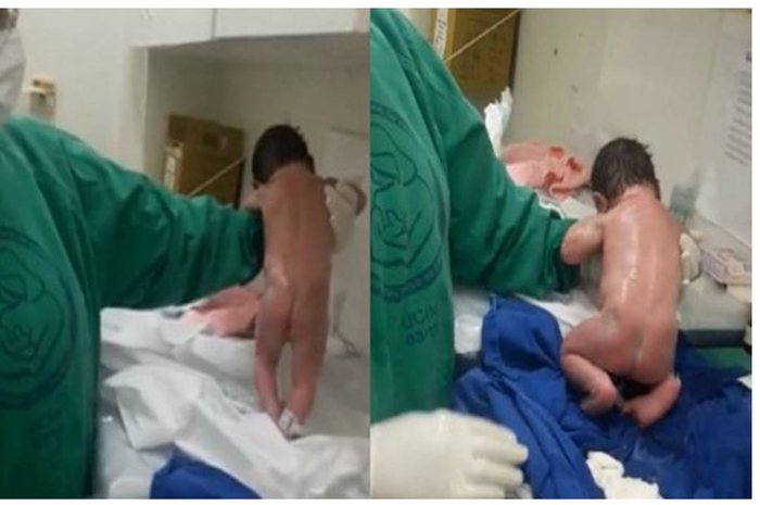 Ajaib bayi baru lahir bisa berjalan