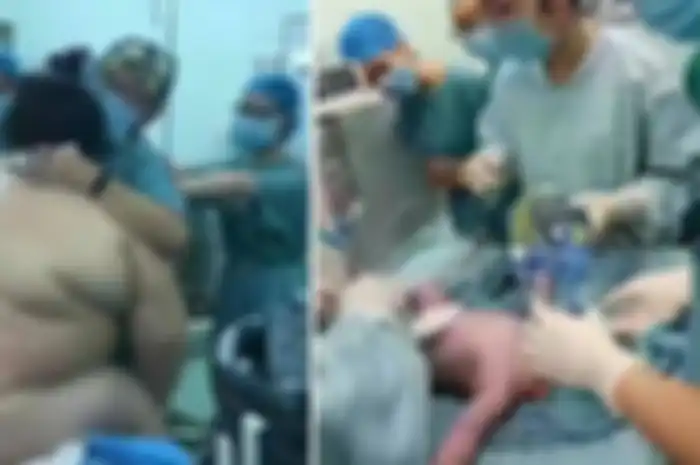Ibu berbobot sangat besar melahirkan dan melibatkan banyak petugas medis.