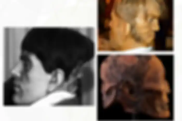 Edward Mordake, pria yang punya dua wajah