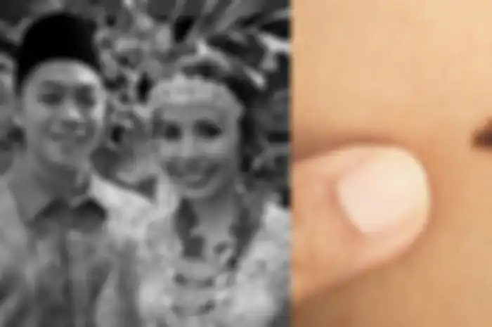 Adara Taista dan Melanoma