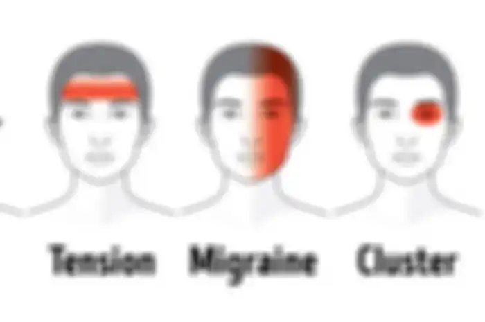 3 jenis sakit kepala yang sering dialami manusia