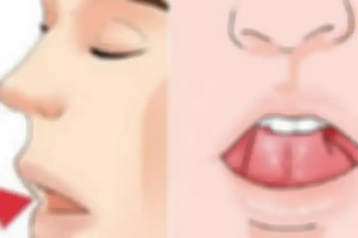 Ilustrasi