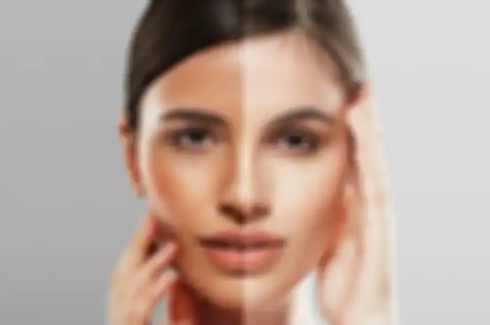 Rekomendasi peeling gel untuk angkat sel kulit mati dan bikin wajah enggak kusam lagi!