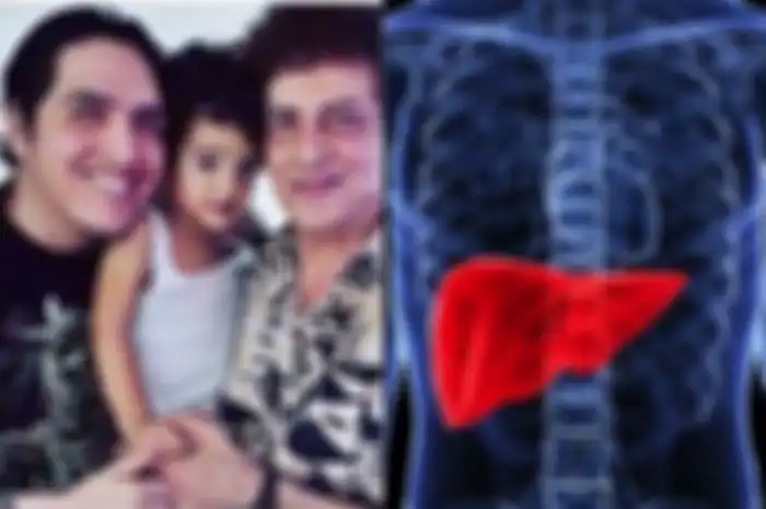 Faldy Albar meninggal karena penyakit liver