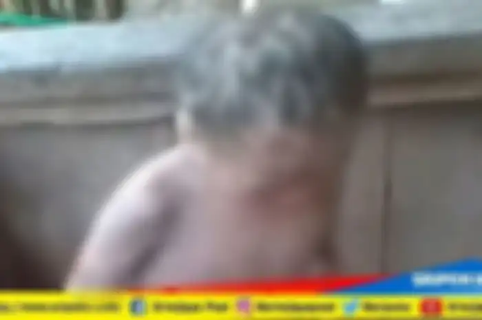 Kulit bocah 5 tahun ini bersisik, sang ayah duga penyebabnya karena bunuh hewan saat istri hamil