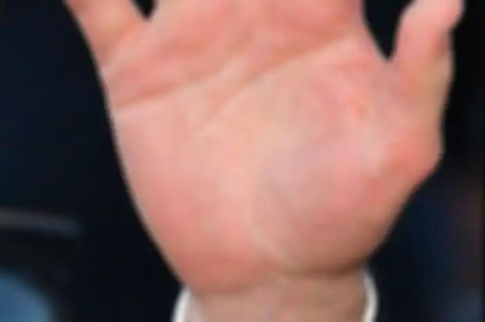 Telapak tangan Pangeran William