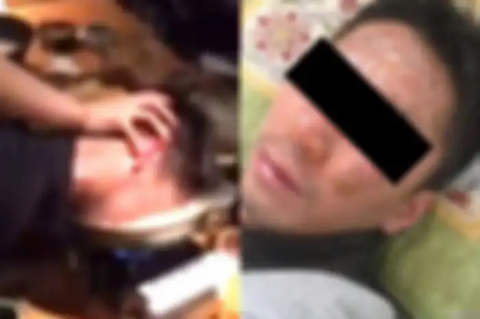 Demi Hibur Klien, Direktur Ini Tega Benamkan Kepala Karyawannya ke Panci Air Panas