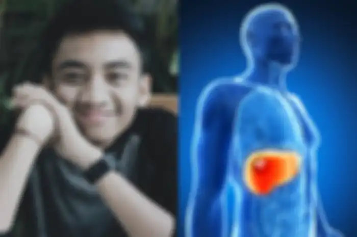 Ciri orang yang rentan terkena kanker hati penyebab komika Gebi meninggal dunia