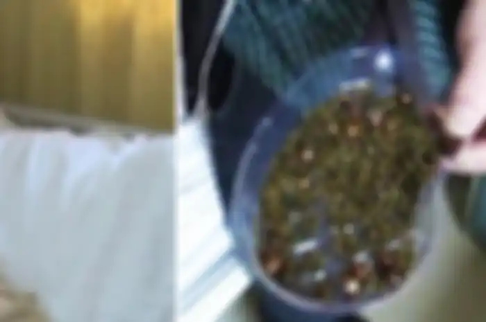 Tak Pernah Sarapan dan Jarang Minum, Wanita Tiongkok Ini Temukan 2000 Batu Empedu di Tubuhnya