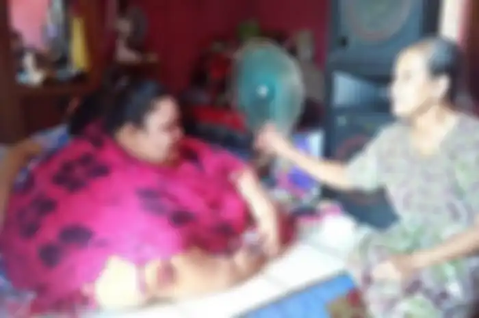 Ingat Titi Wati yang Obesitas hingga 350 Kg? Begini Kondisinya Sekarang Usai Operasi Saluran Pencernaan