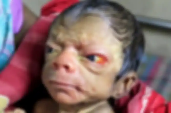 Baru dilahirkan, bayi ini memiliki wajah seperti orang tua