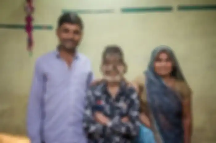 Latit Patidar (13) menderita werewolf syndrome, membuat wajahnya dipenuhi oleh rambut hingga diperlakukan kurang baik