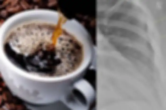 7 Tahun Kecanduan Minum 10 Gelas Kopi Sehari, Wanita ini Alami Hal Mengerikan Pada Tubuhnya