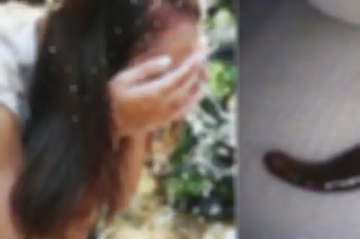 Mengerikan! Wanita Ini Menemukan Lintah Berukuran 5 Cm di Hidung Usai Membasuh Wajah dengan Aliran Air di Gunung