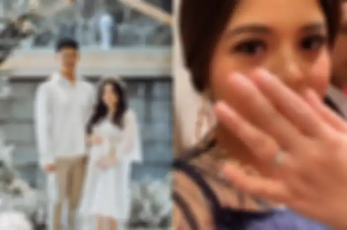 Jari manis Tasya Kamila membengkak
