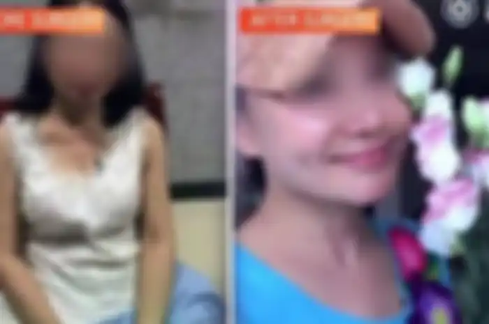 Jadi Buronan, Nenek ini Berhasil Kelabui Polisi karena Tampil Bak ABG Berkat Operasi Plastik