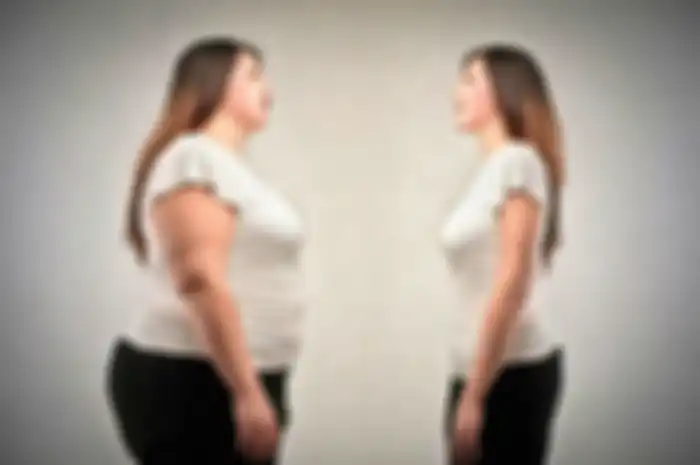 Ilustrasi penderita obesitas