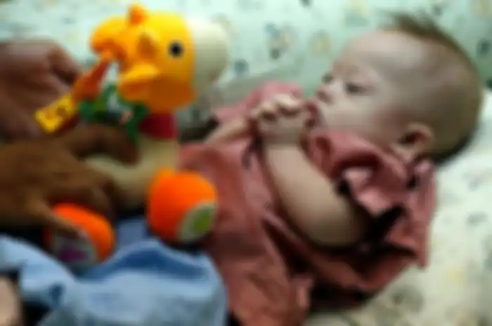 Gammy yang ditinggalkan orangtua aslinya karena menyandang down syndrome